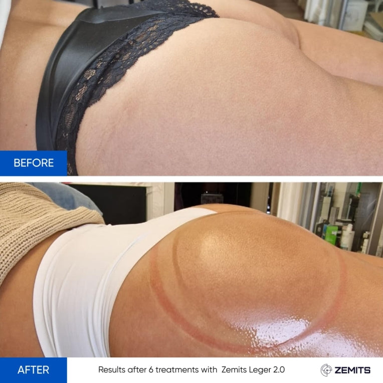 Zemits Leger 2.0 Vákuový bankový systém s XXL pohármi v sade